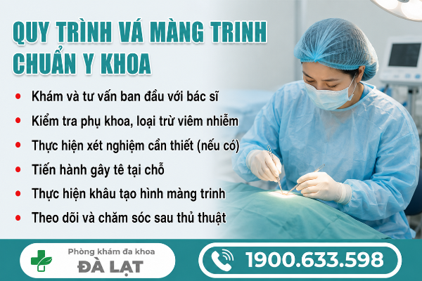 Hình ảnh minh họa